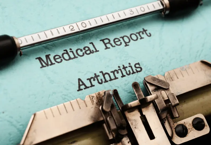 Are your stiff joints arthritis?