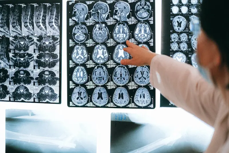 How can you use food to future-proof your brain?